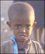 One of the millions of starving Ethiopians during the Famine of 1984-85